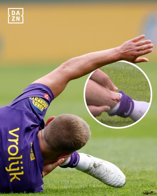 荷甲球员霍尔特比重伤引护腿板争议升级